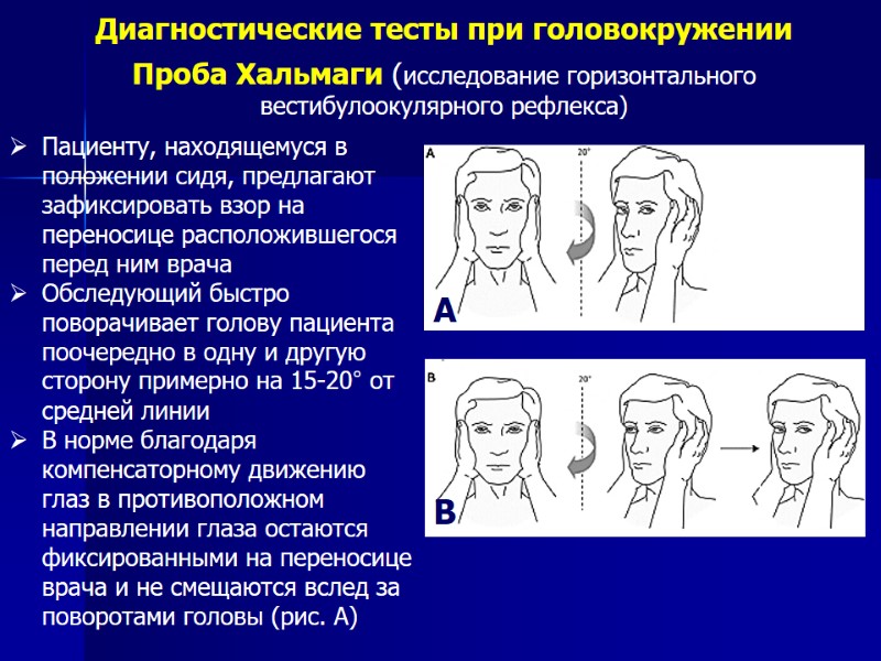 Диагностические тесты при головокружении Проба Хальмаги (исследование горизонтального вестибулоокулярного рефлекса) Пациенту, находящемуся в положении